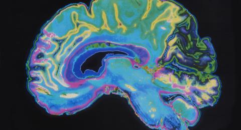 brain scan