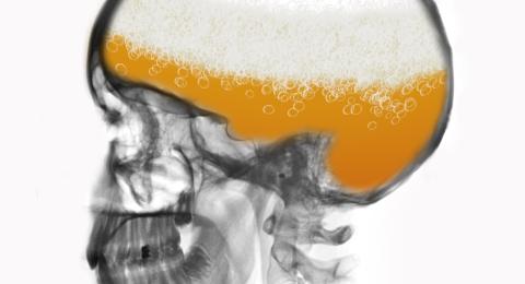 xray of skull filled with beer
